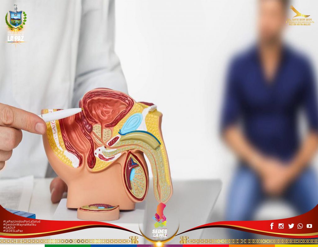 Tres de cada diez colombianos mayores de 50 años padecen de cáncer de próstata