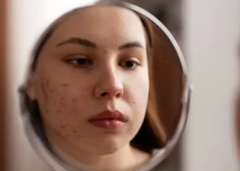 Retención de líquidos: un problema silencioso que afecta tu cuerpo y tu rostro